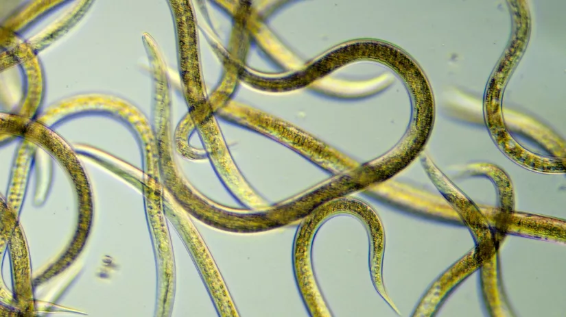 Hoe zien aaltjes eruit? Hoe zien aaltjes eruit?